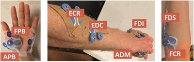 Accounting for Stimulations That Do Not Elicit Motor-Evoked Potentials When Mapping Cortical Representations of Multiple Muscles
